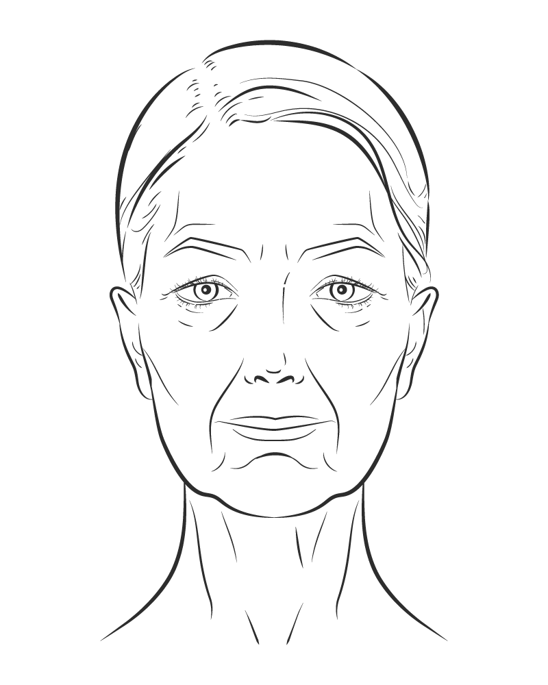 Visible Laxity